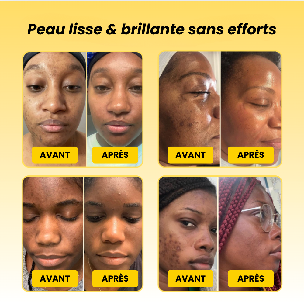 Masque de nuit au Curcuma & Acide Kojique